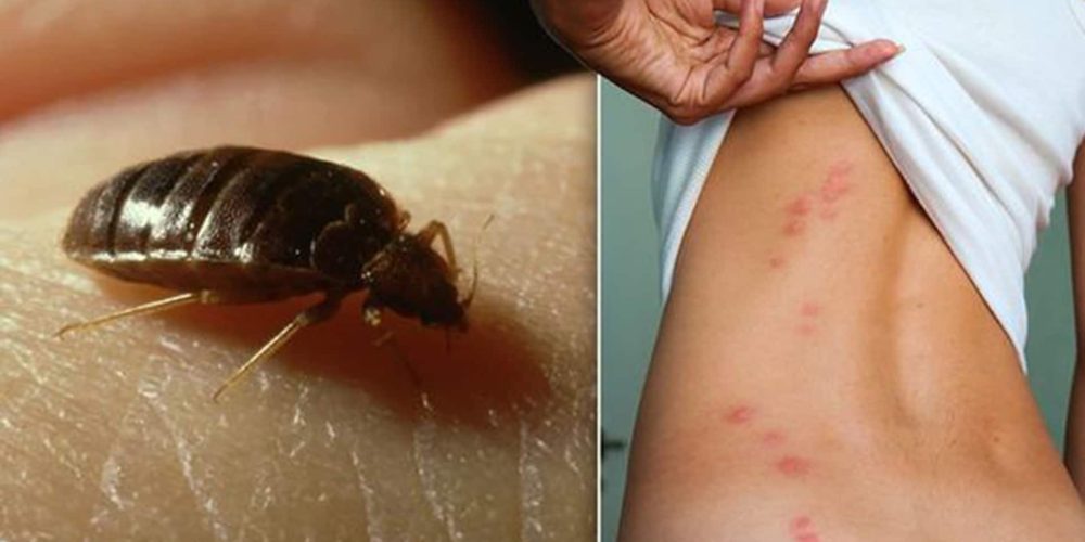 Comment prévenir une infestation de punaises de lit dans sa maison ?